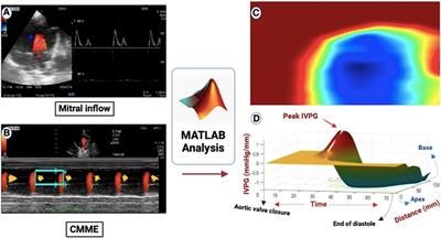 Effect of trehalose on heart functions in rats model after myocardial infarction: assessment of novel intraventricular pressure and heart rate variability